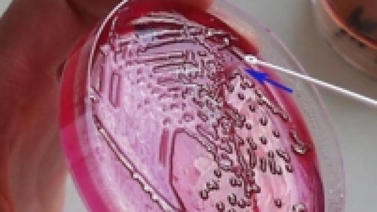 israel o bacterie ucide zeci de oameni