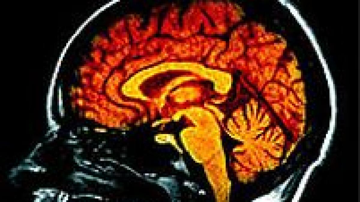 saptamana creierului la bucuresti