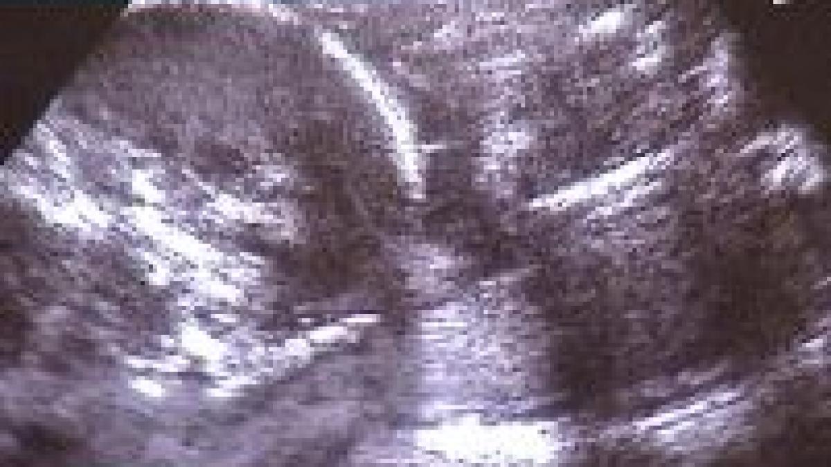 Află sexul copilului în săptămâna a şasea