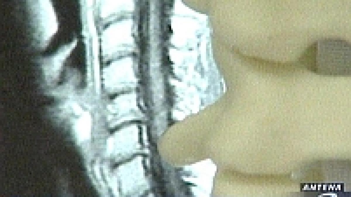 operatie in premiera pentru bolnavii de hernie