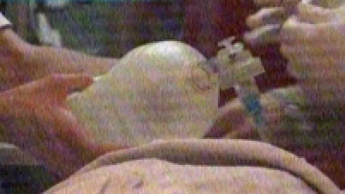 chirurgii aduc bani si instrumente de acasa pentru operatii video