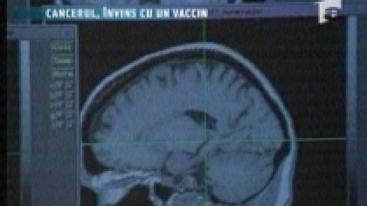 sua a fost descoperit un vaccin revolutionar impotriva cancerului la creier