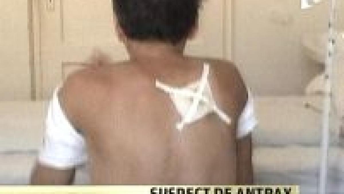 un barbat din uricani este suspect de antrax