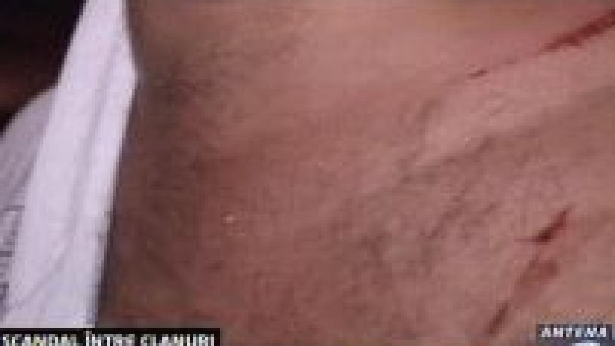 scandal intre 2 clanuri de rromi la timisoara video