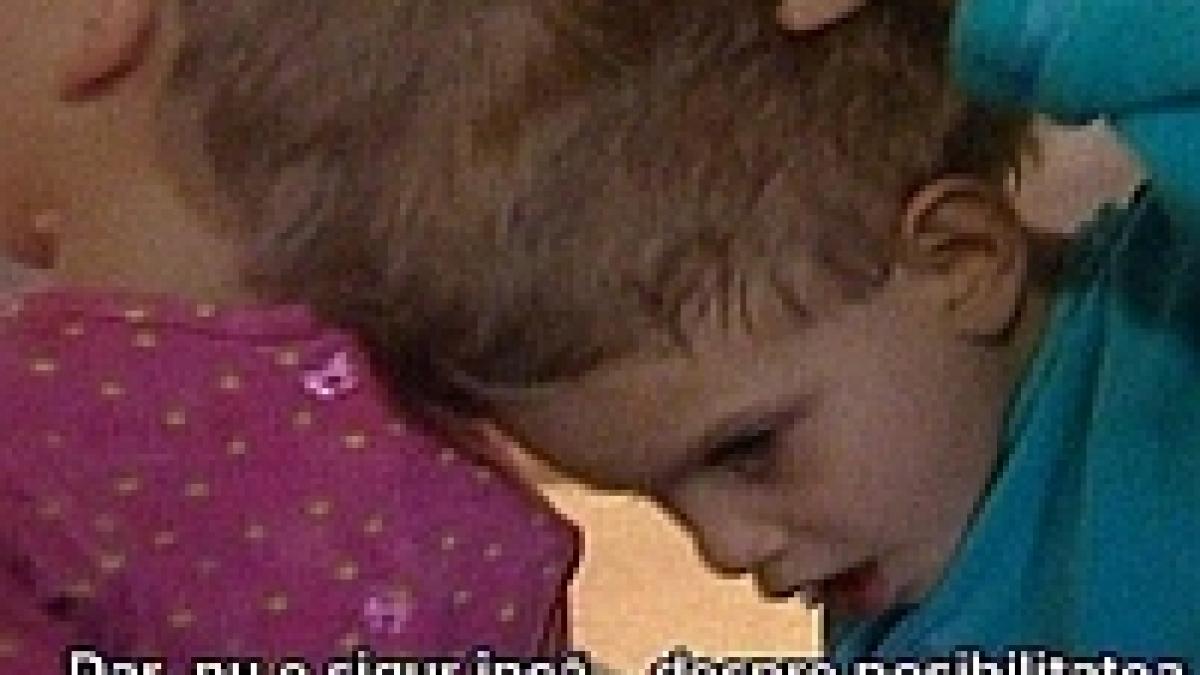 cazul siamezelor romance preluat de o noua echipa de medici