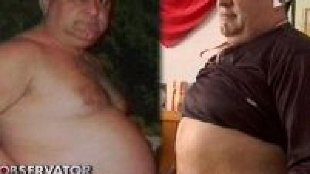 un primar din arges si a facut liposuctie ca sa fie reales