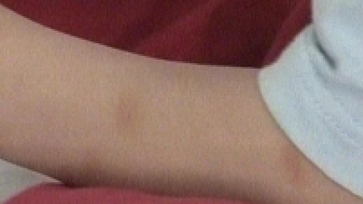 un baietel a fost batut de o asistenta medicala din cauza unei injectii video