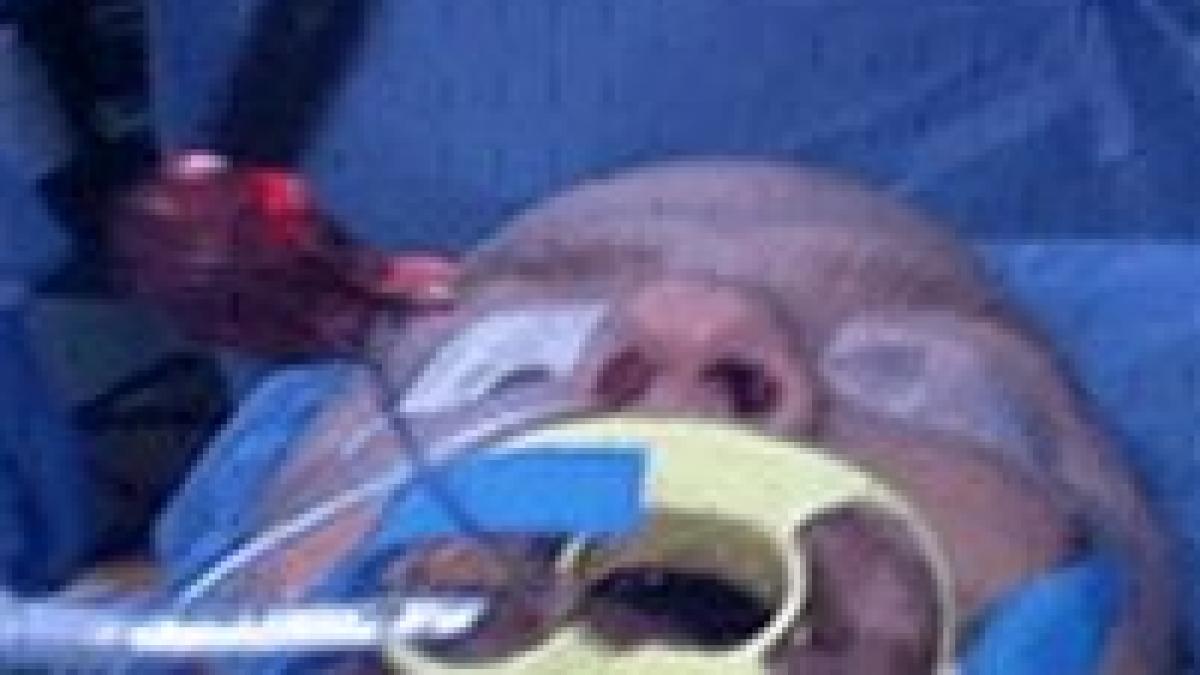 eficient si fara urme operatia de apendicita se face acum si prin gura