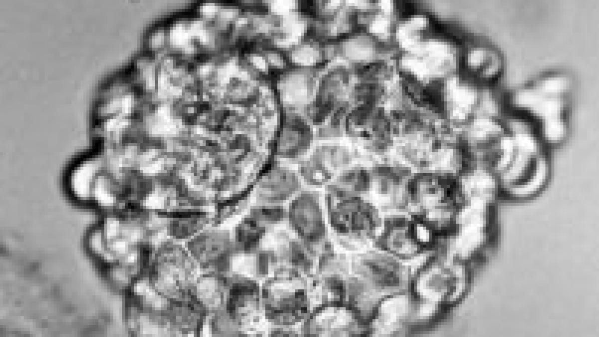 la cluj a aparut prima banca privata de celule stem din romania