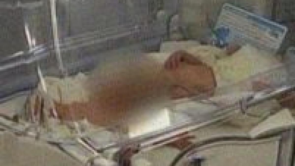 brasov o tanara de 16 ani a nascut o pereche de siamezi dintr o relatie incestuoasa