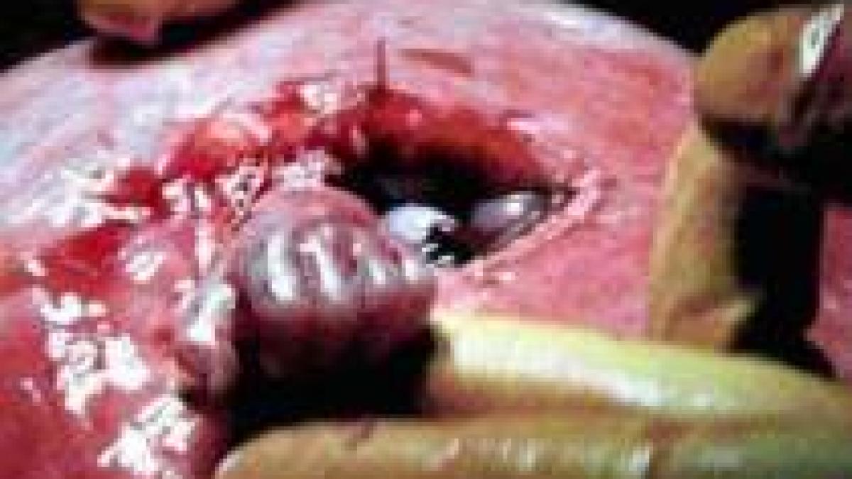 mana fetusului care a impresionat lumea povestea controversata a unei fotografii