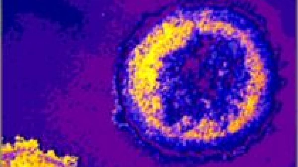 tratament impotriva hiv sida succes in laborator urmeaza testele pe oameni