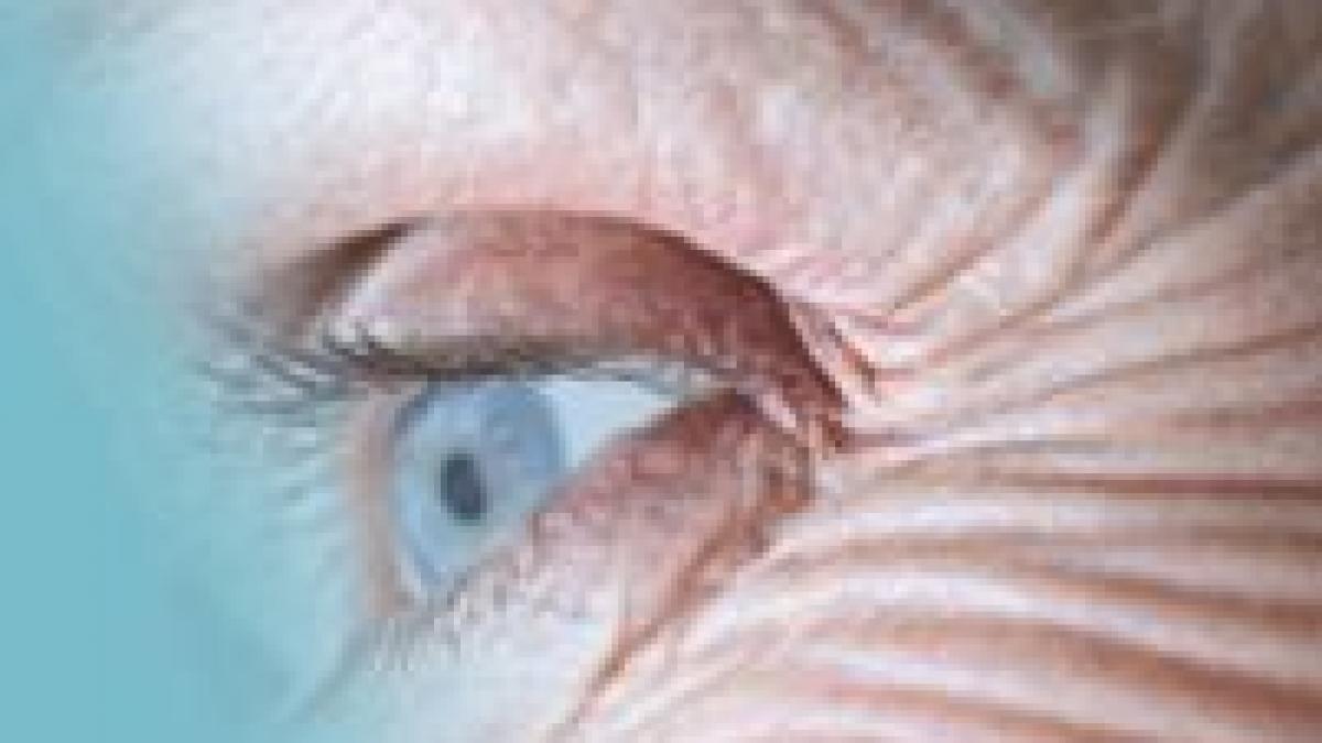 antioxidantii sunt ineficienti in lupta impotriva imbatranirii