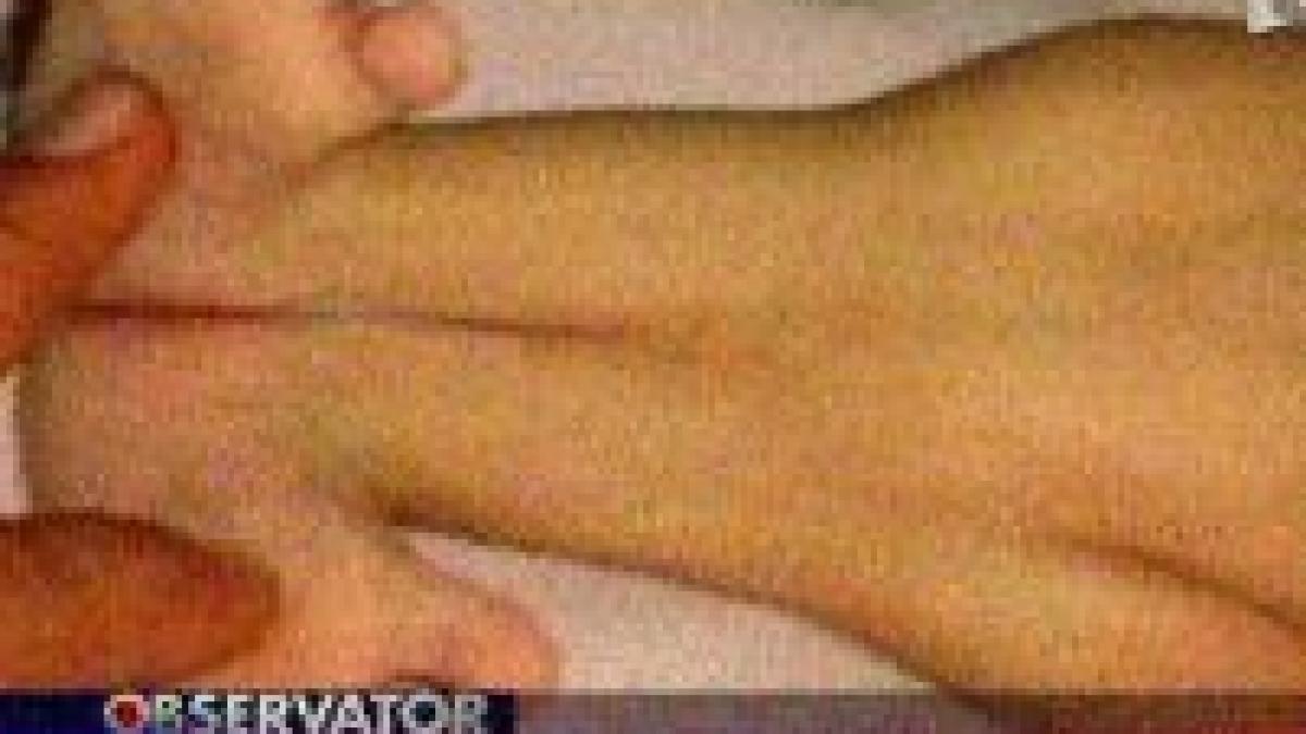 la maternitatea brasov s a nascut un copil sirena