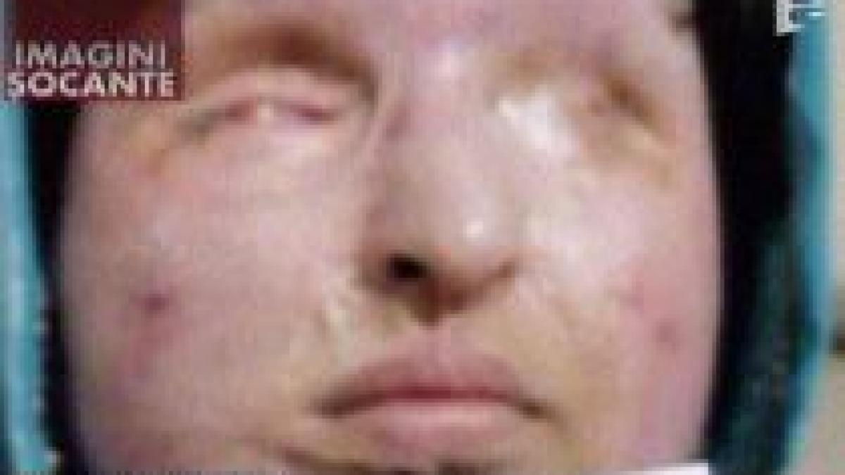 i a aruncat cu acid sulfuric in fata si va avea parte de aceeasi pedeapsa