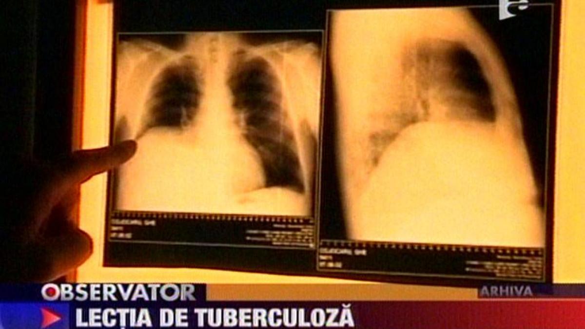 brasov zeci de liceeni ar putea fi bolnavi de tuberculoza din cauza unui profesor