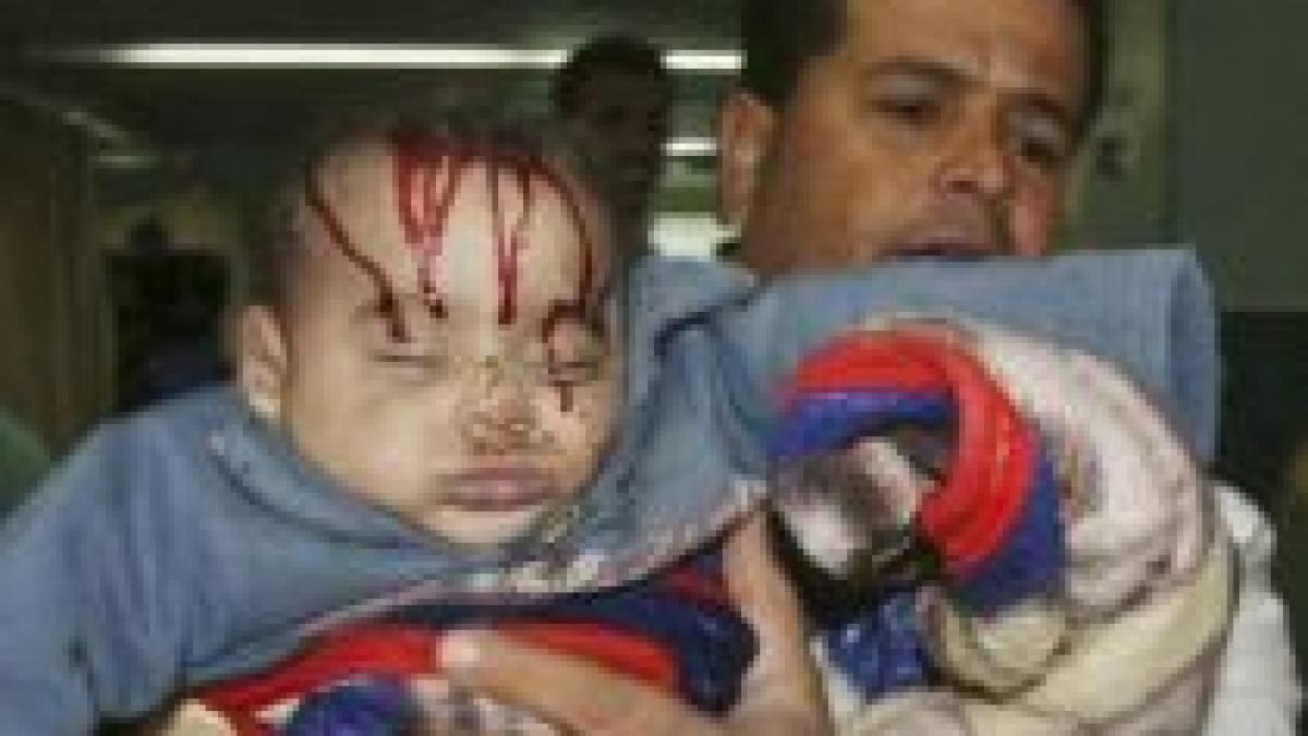 o copilarie traumatizata de bombardamentele din gaza imagini socante