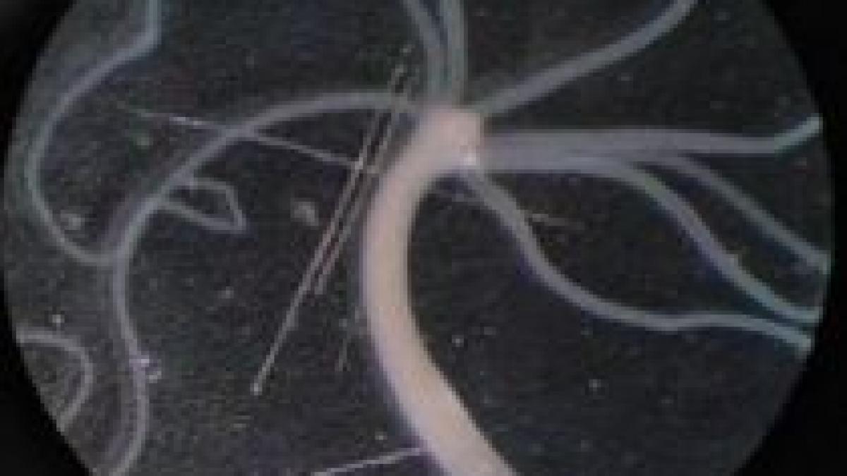 o proteina care ar putea imbunatati tratamentul cu antibiotice descoperita de cercetatori