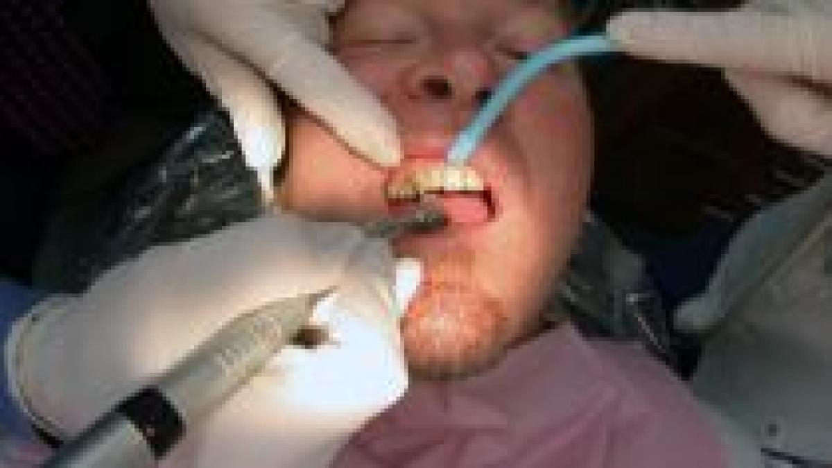 iasi un dentist amator i a taiat pacientului o bucata de limba cu freza