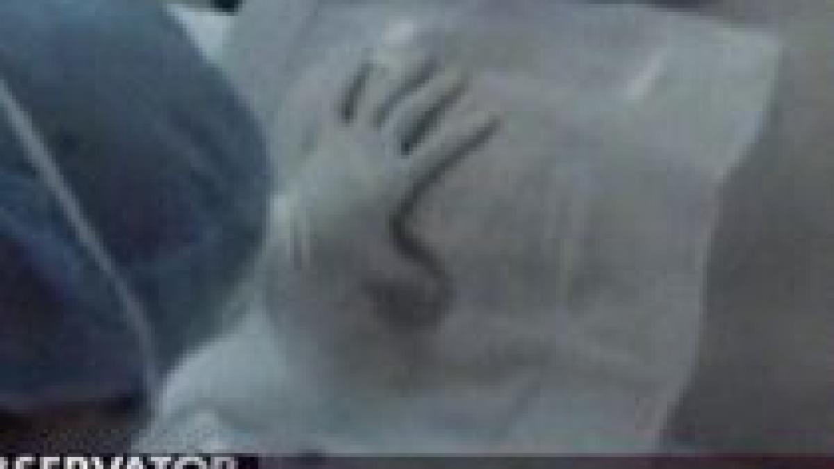 semnal de alarma un israelian s a imbolnavit de cancer dupa terapia cu celule stem