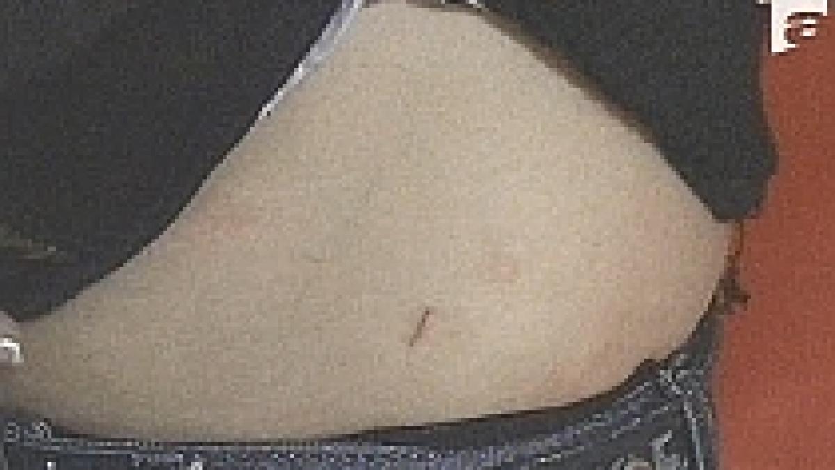 cinci eleve au fost intepate cu bolduri la un liceu din gaesti in institutie invata si seropozitivi