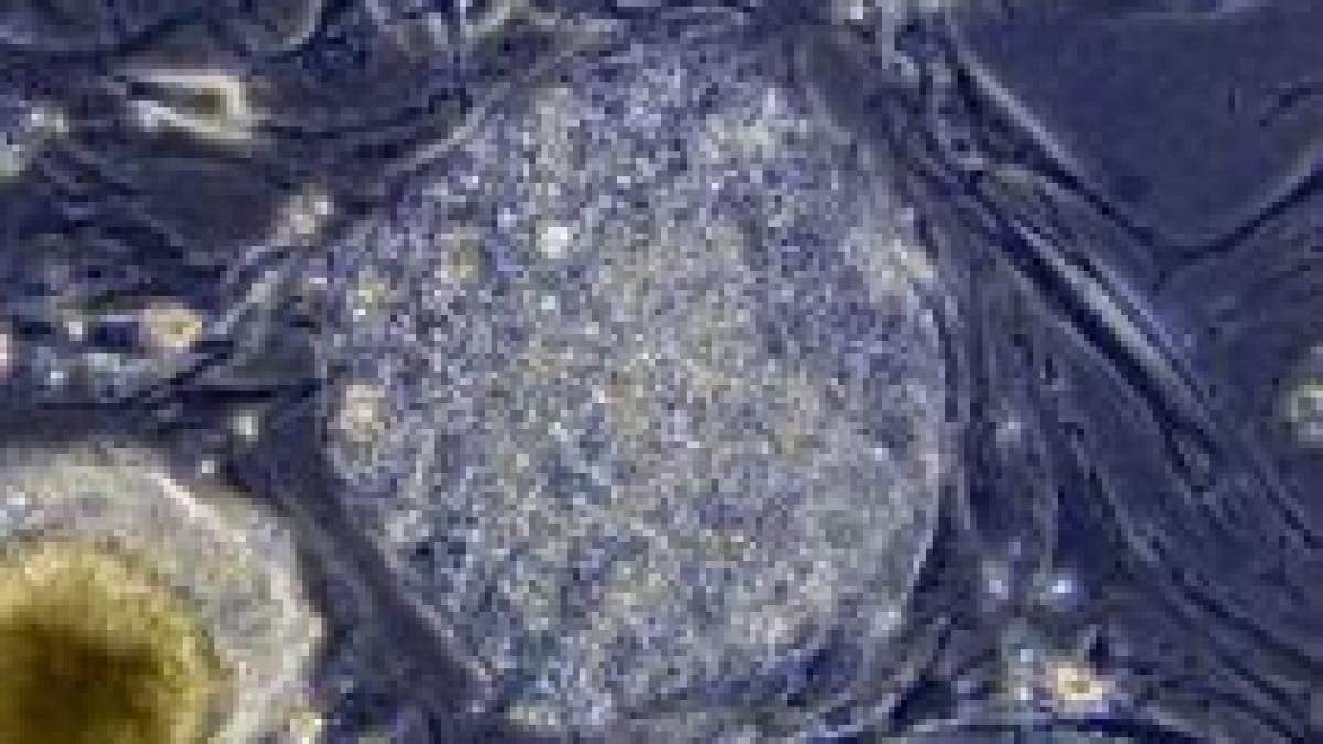 obama autorizeaza finantarea cercetarii in domeniul celulelor stem