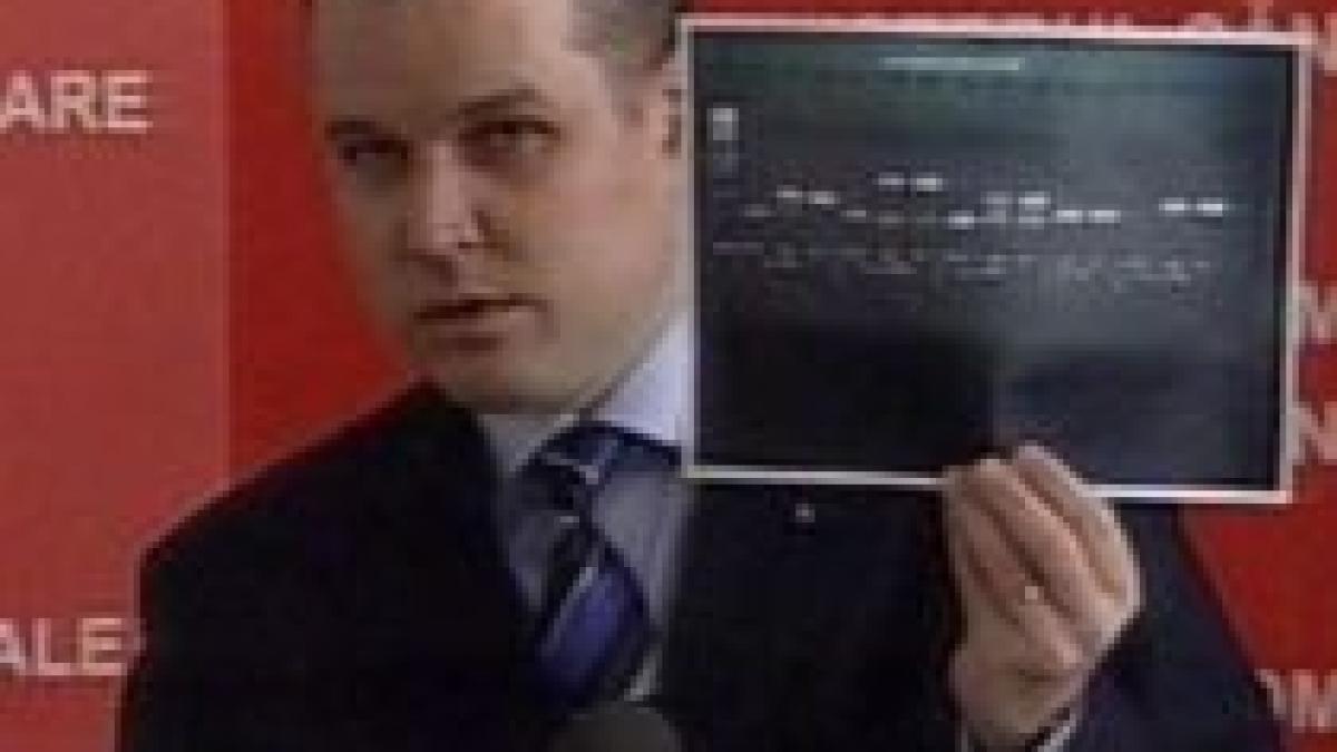 trei cazuri de gripa porcina confirmate in bucuresti pacientii internati la matei bals