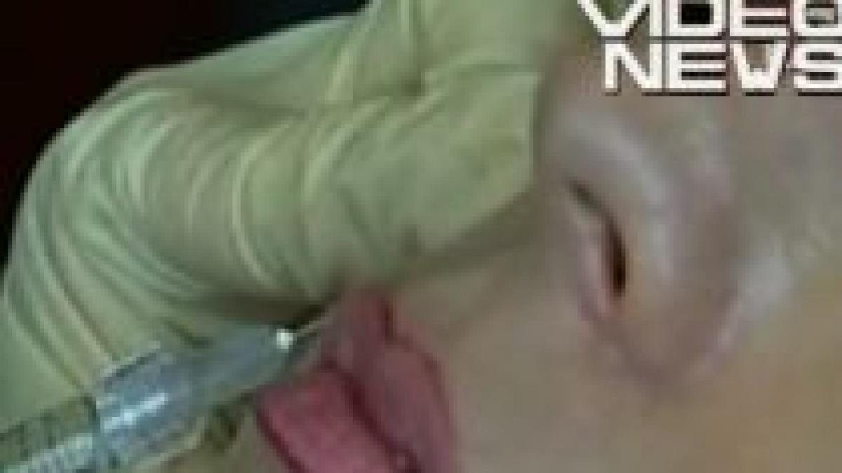 injectiile cu acid hialuronic la mare cautare printre romancele lovite de criza video