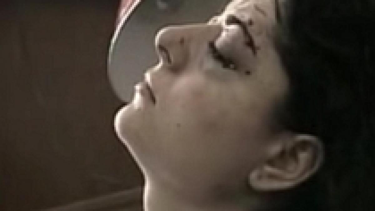 i a scos ochiul nevestei pentru ca n a vrut sa se impace cu el imagini socante