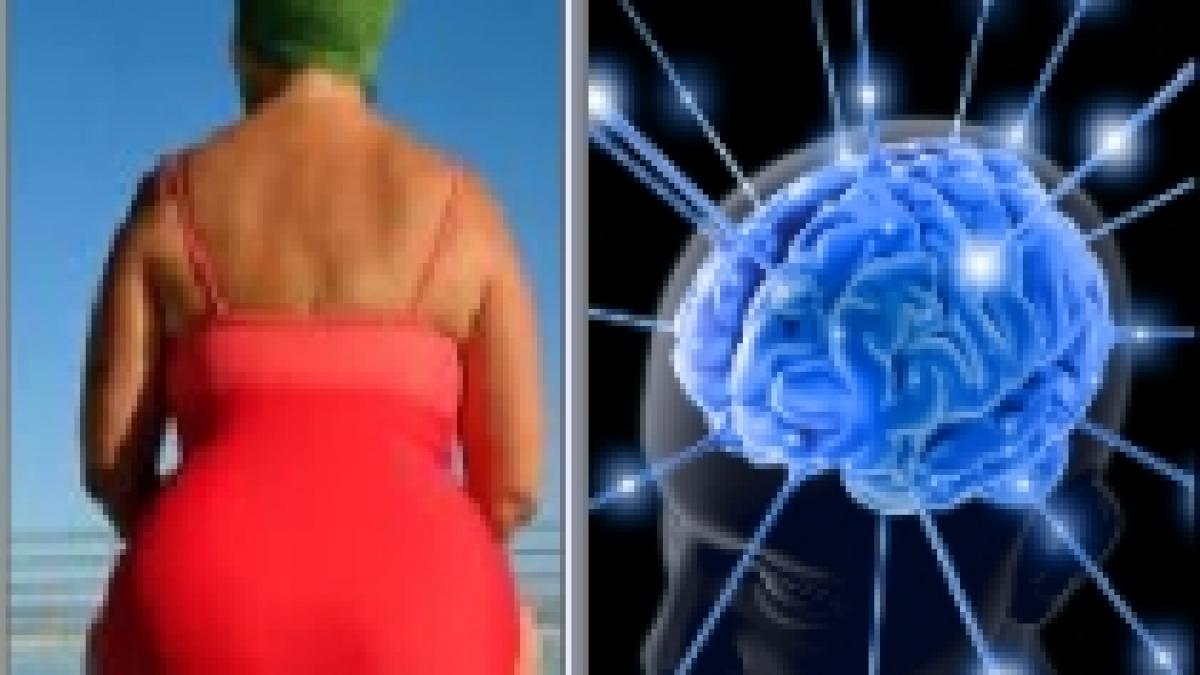 studiu creierul obezilor mai mic decat al persoanelor cu greutatea normala