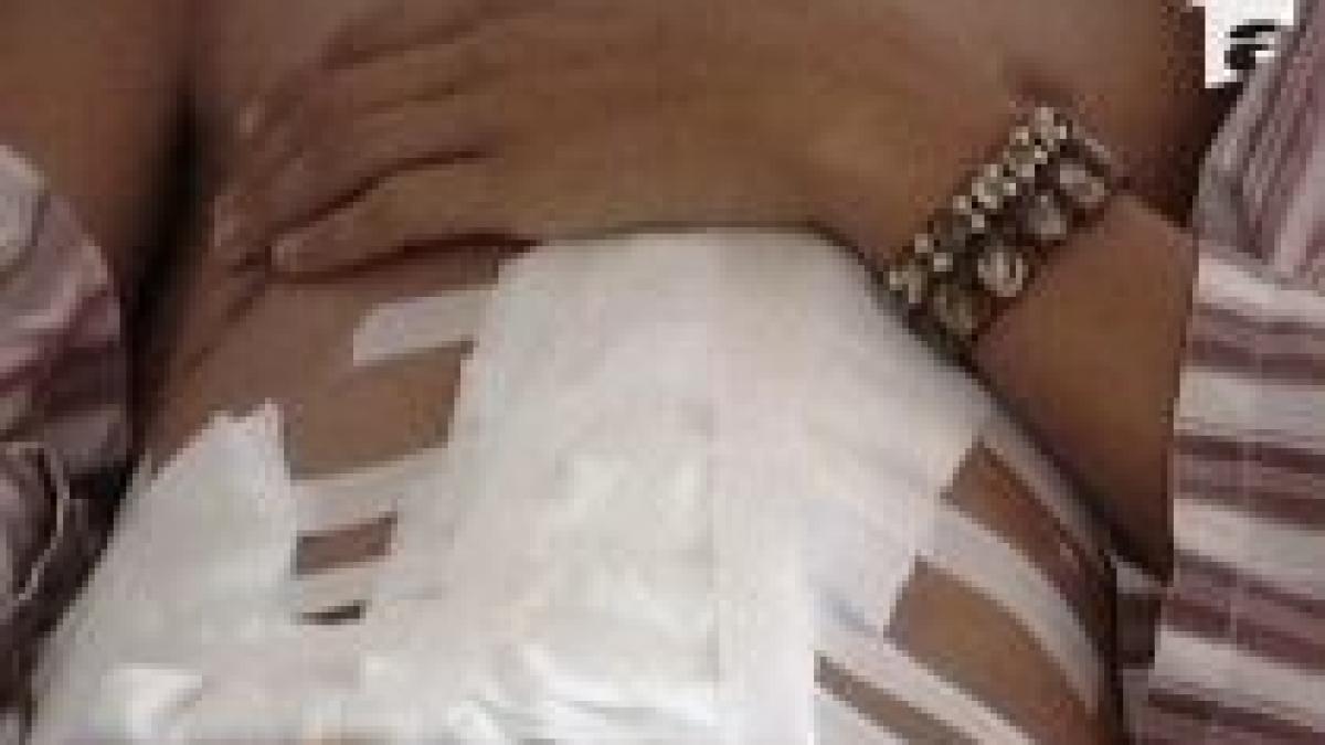 hunedoara un baiat de 15 ani sustine ca a fost batut de politisti care l au confundat cu un hot