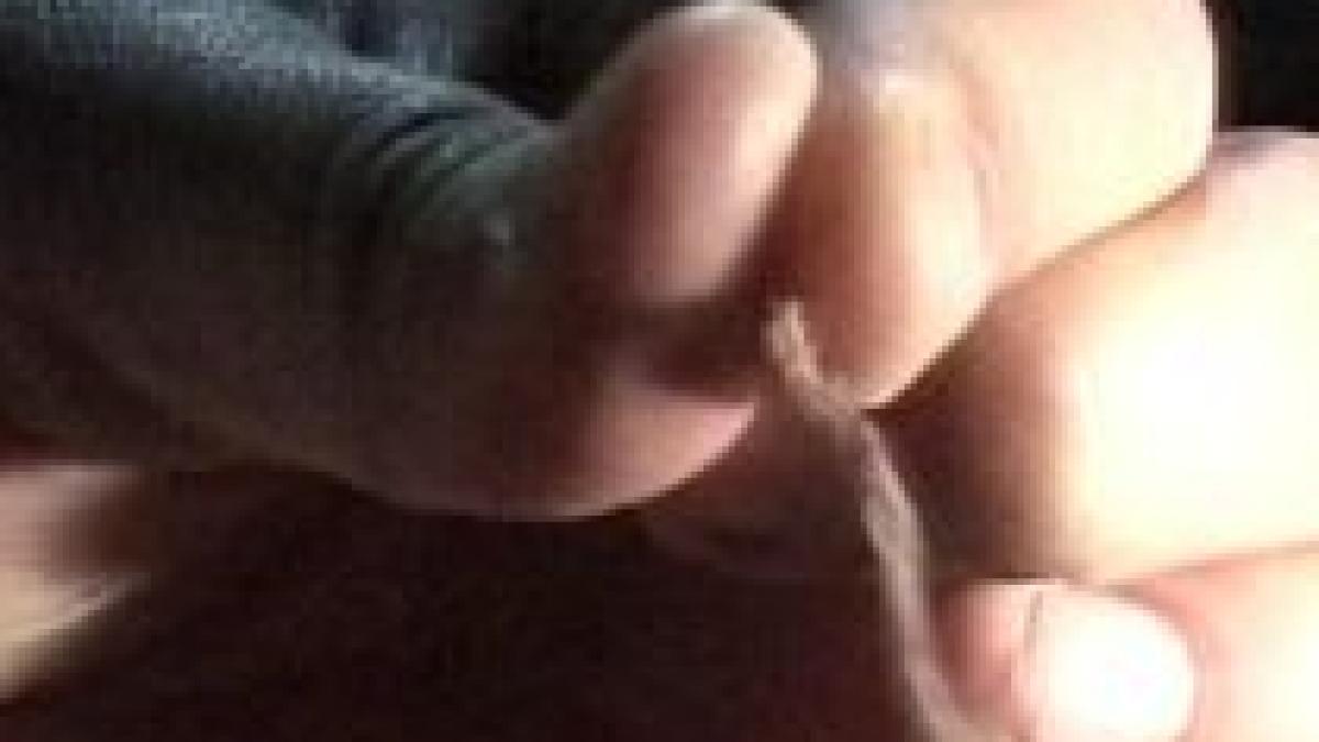 acuzatie de malpraxis parintii sustin ca un medic a uitat pansamente in corpul unei fetite din