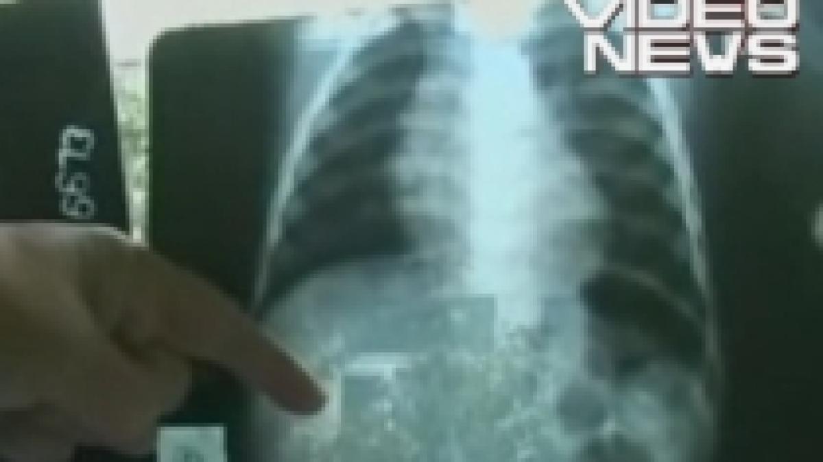 arad un bebelus a ajuns la spital cu un ac infipt in spate video