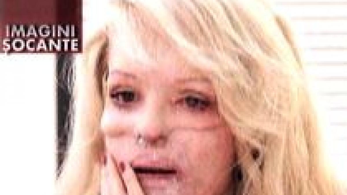 poveste tragica a fost violata si desfigurata cu acid de iubitul sau gelos video