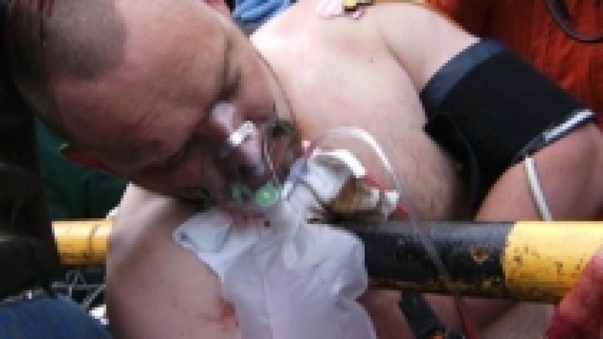 barbat cu pieptul perforat de o bara groasa de otel sefu am o mica problema foto