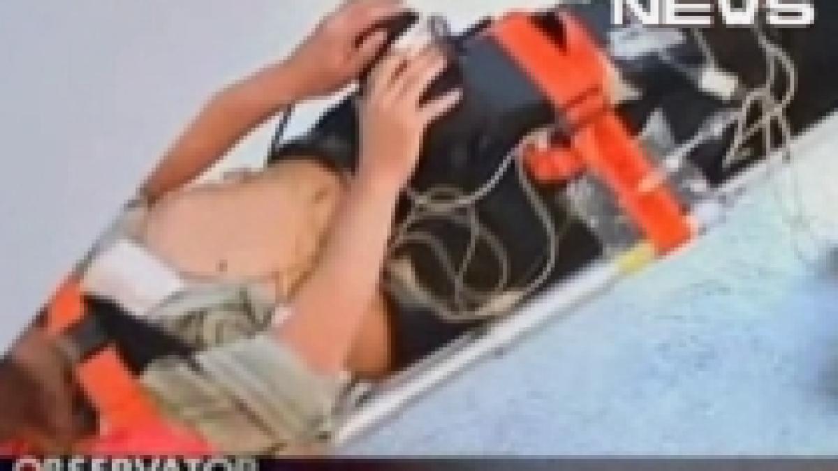 sinucidere ratata s a impuscat in cap si a supravietuit video