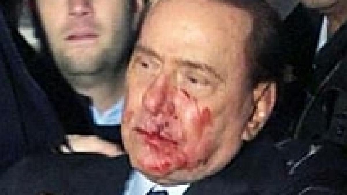 silvio berlusconi cu nasul fracturat si dintii sparti dupa ce a fost lovit in fata la milano video