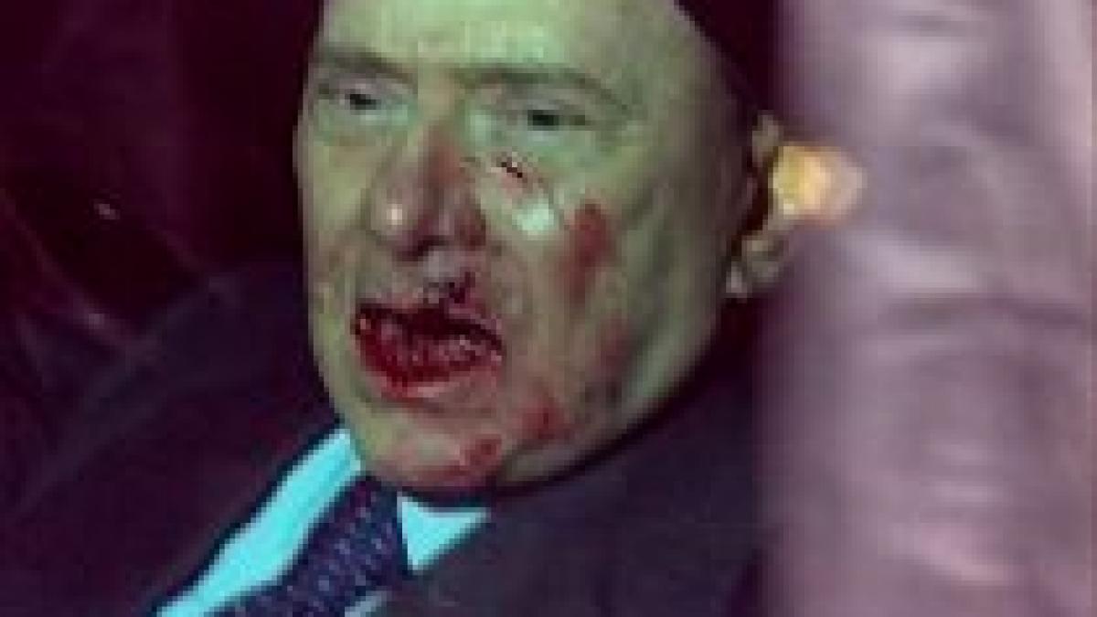 moda trucajelor berlusconi si a inscenat atacul din milano video