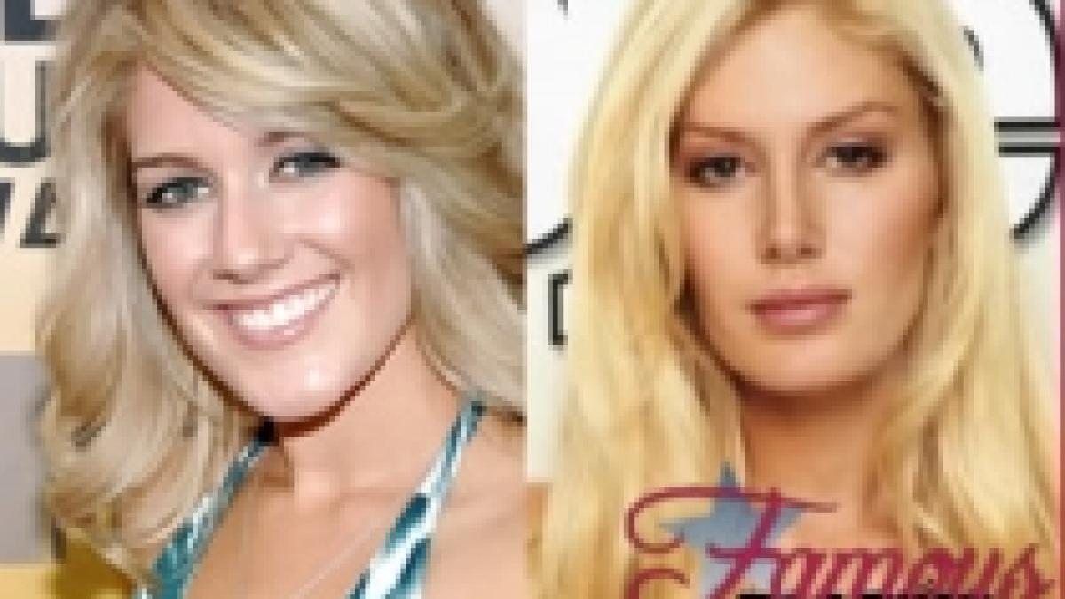 obsesie pentru chirurgia plastica a facut 10 operatii estetice intr o singura zi foto