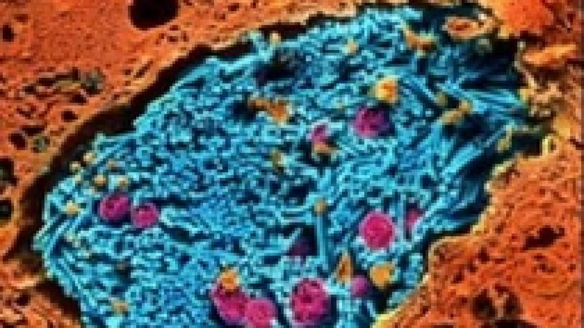 europa in alerta drogurile contaminate cu antrax continua sa ucida oameni