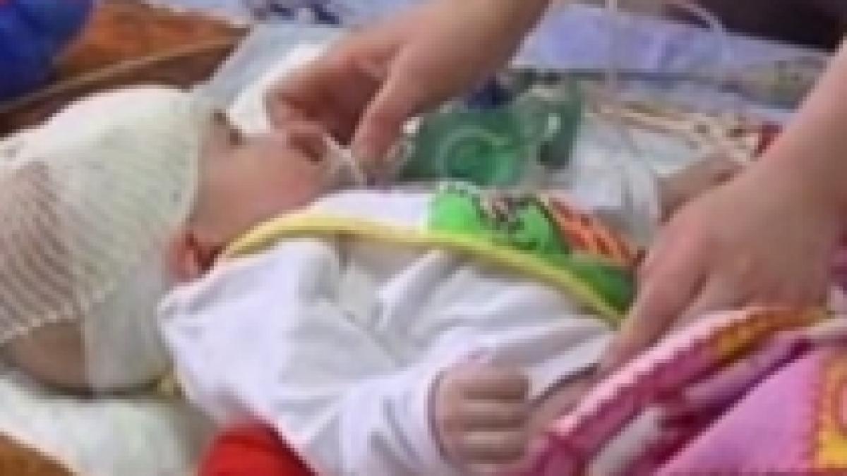 premiera medicala un bebelus de patru luni a fost operat pe creier video