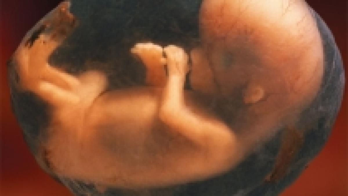 medicii din iasi refuza sa opereze avorturi in saptamana mare