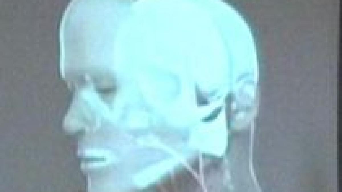 spania doctorii au realizat primul transplant facial total din lume video