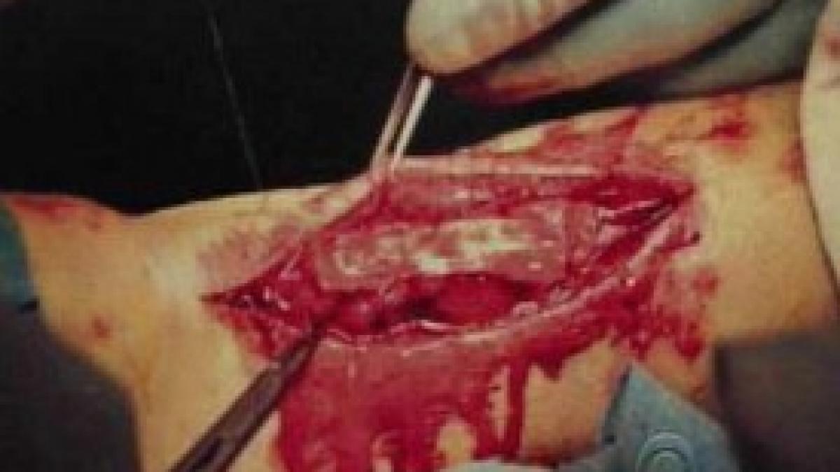 beckham prezinta o fotografie din timpul operatiei la tendonul lui ahile in emisiune la letterman