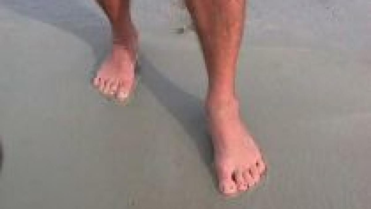 un iesean a ajuns la spital cu arsuri grave dupa ce a amestecat cu picioarele cimentul de