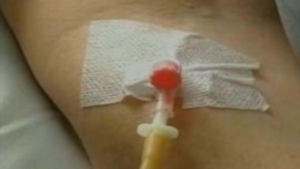 imagini socante o femeie paralizata mancata de viermi pana la os video