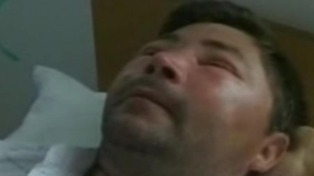 iasi un barbat a ajuns in stare grava la spital dupa ce a fost atacat de viespi video