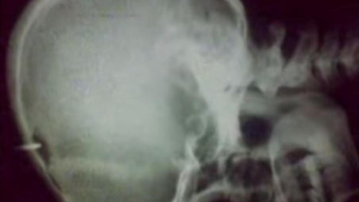 un detinut si a cusut gura cu sarma si si a batut un cui in cap in semn de protest video