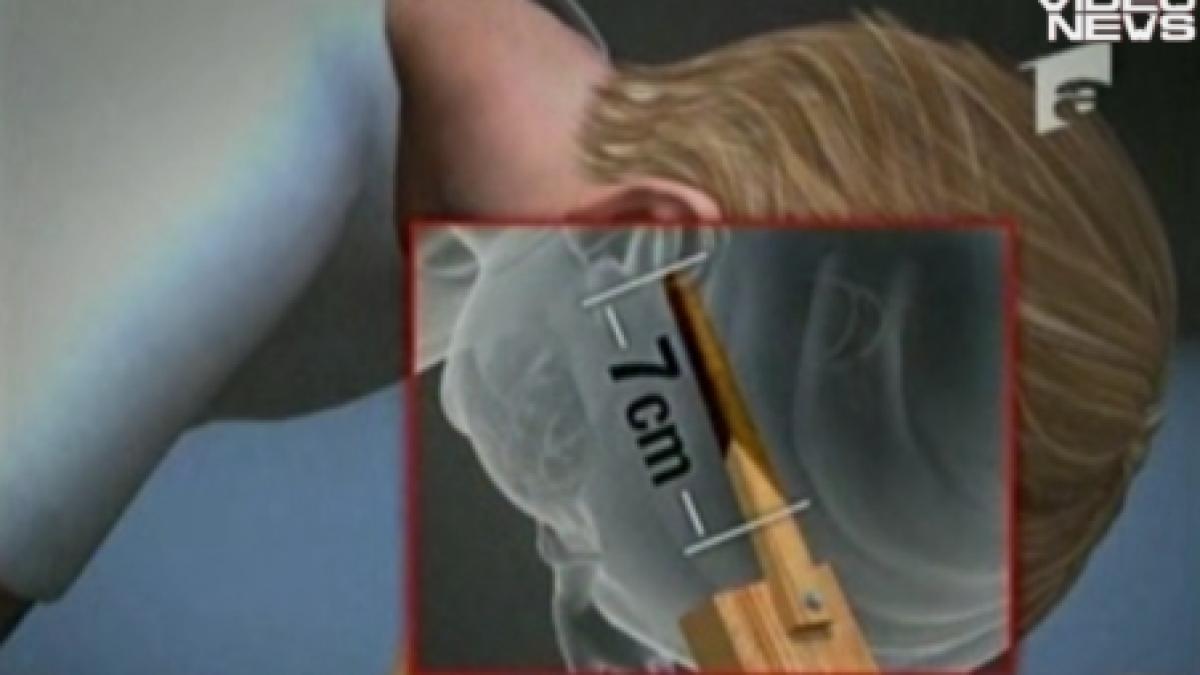 bihor un copil traieste dupa ce a stat 10 ore cu o scandura infipta in cap video