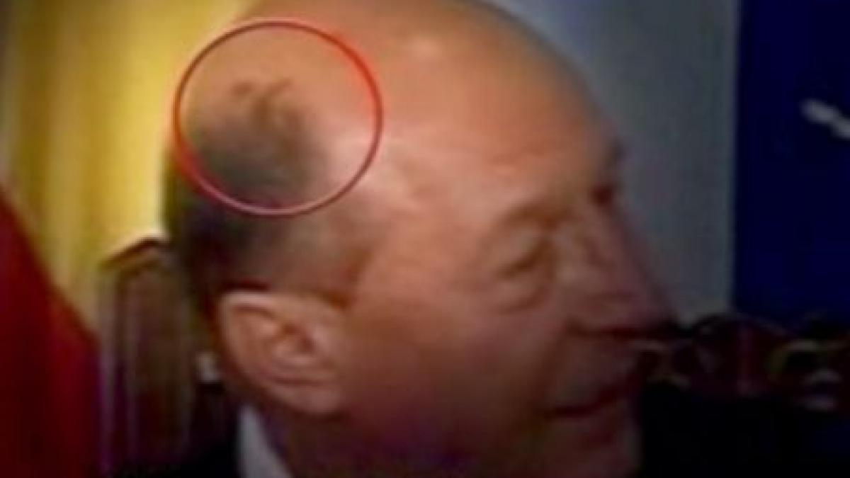 presedintia despre petele suspecte aparute pe capul lui traian basescu nu sunt motive de